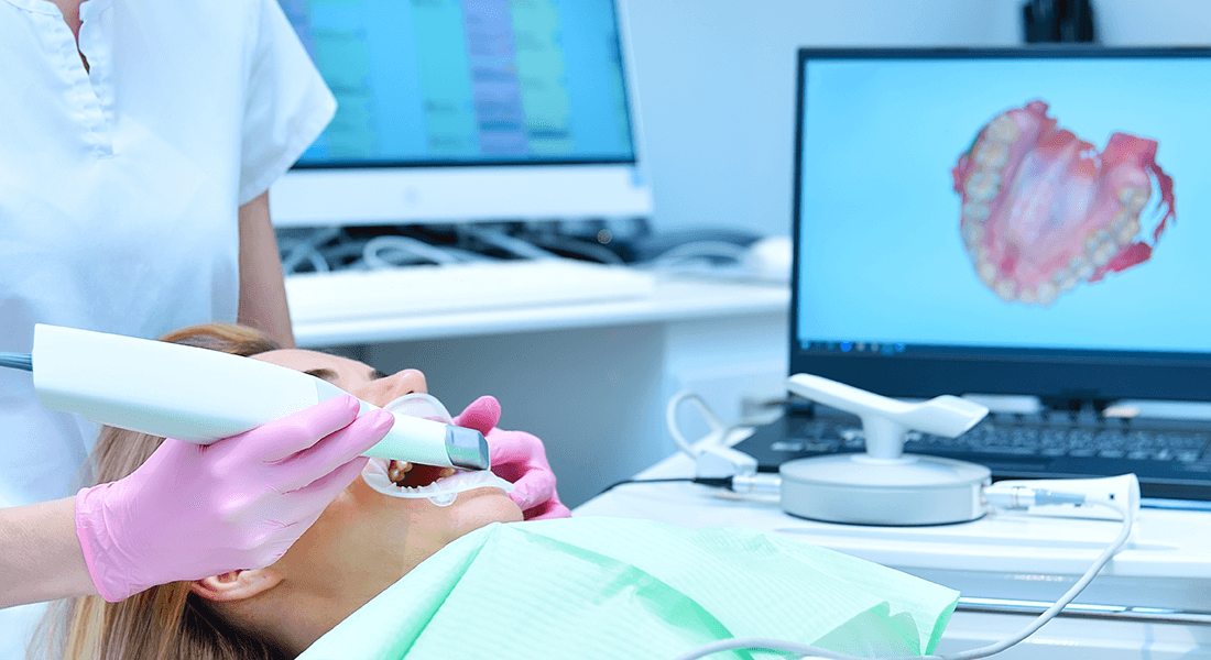 digital scanning af tænderne